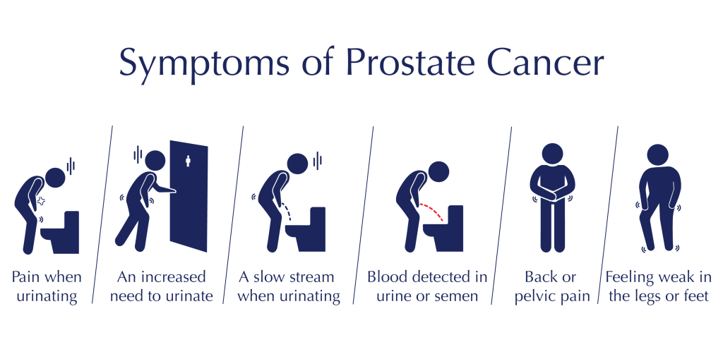Symptoms of Prostate Cancer