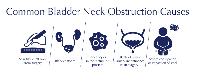 Common Bladder Neck Obstruction Causes